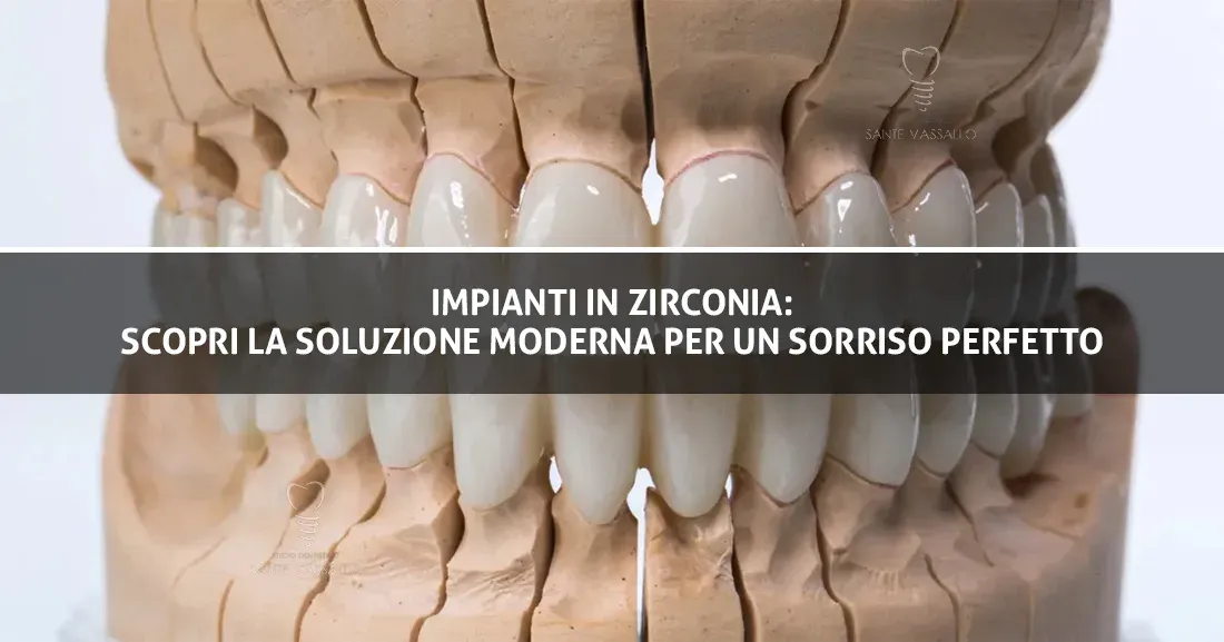 Impianti-in-Zirconia-Scopri-la-Soluzione-Moderna-per-un-Sorriso-Perfetto---Copertina---Studio-Dentistico-Sante-Vassallo
