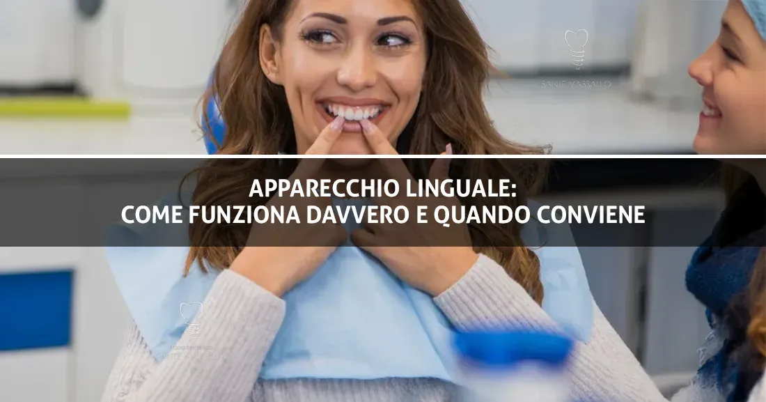 Apparecchio linguale - come funziona davvero e quando conviene