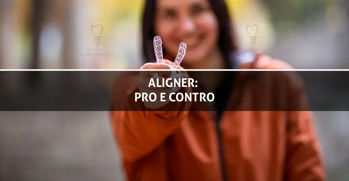 Aligner: pro e contro