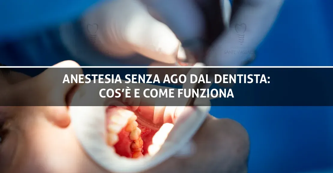 Anestesia senza ago dal dentista: cos’è e come funziona