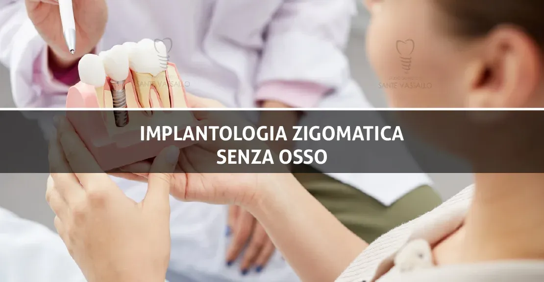 Implantologia zigomatica senza osso