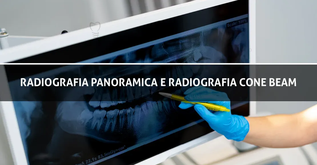 Radiografia panoramica e radiografia Cone Beam