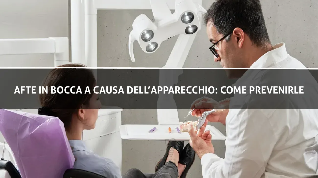 Afte in bocca a causa dell'apparecchio: Come pprevenirle