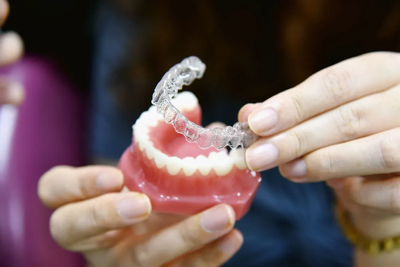tipologie-di-bite-dentale