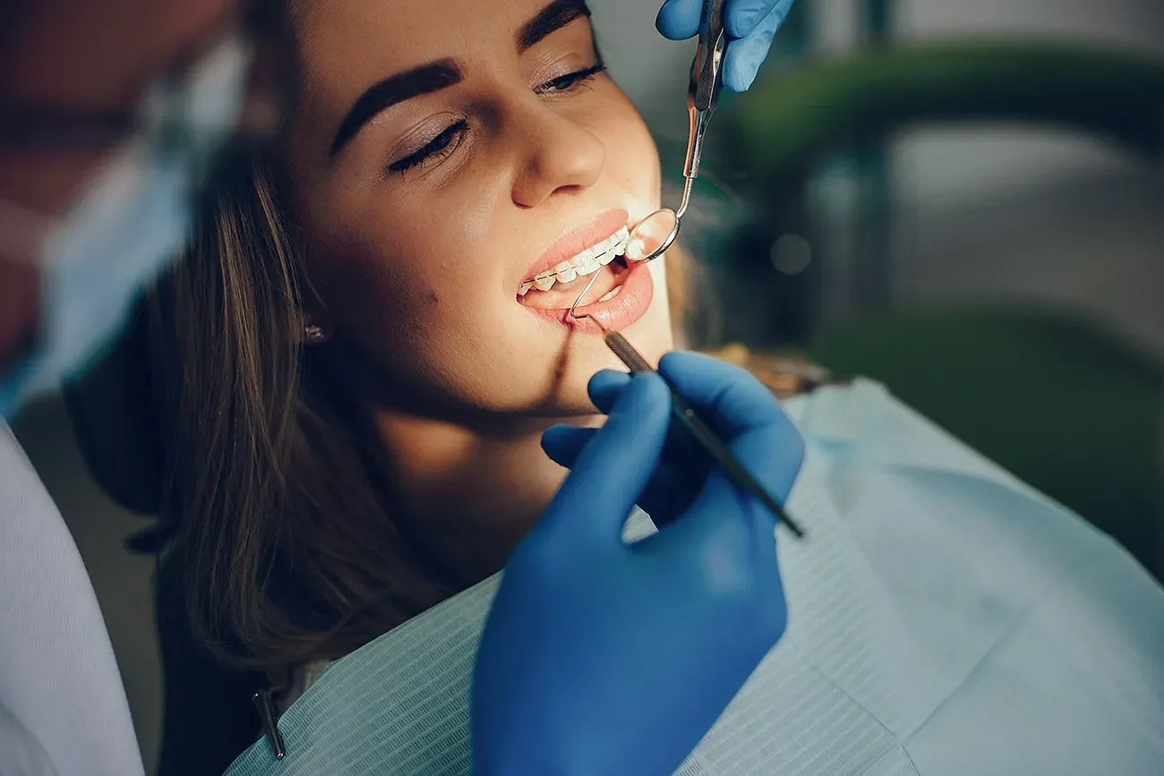 denti-storti