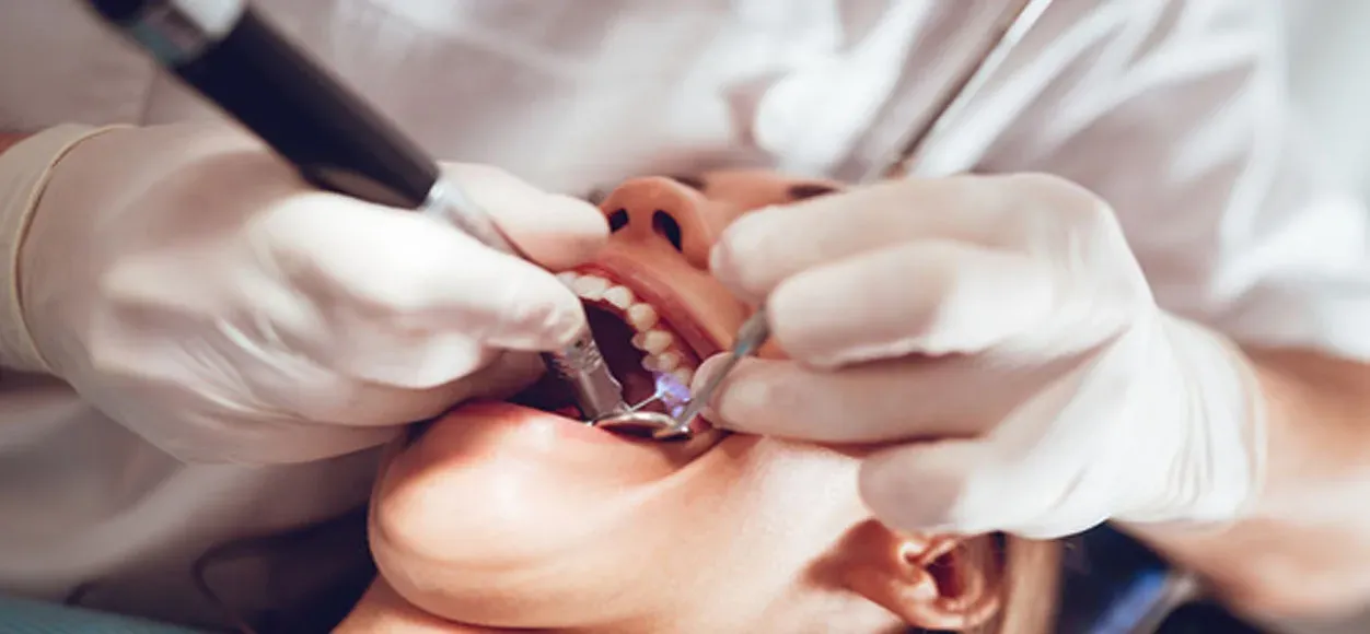 Fasi della devitalizzazione dentale