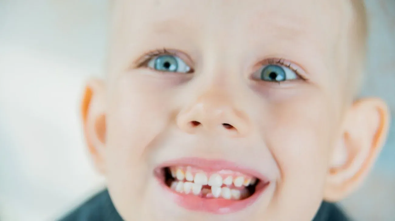 come proteggere i denti da latte