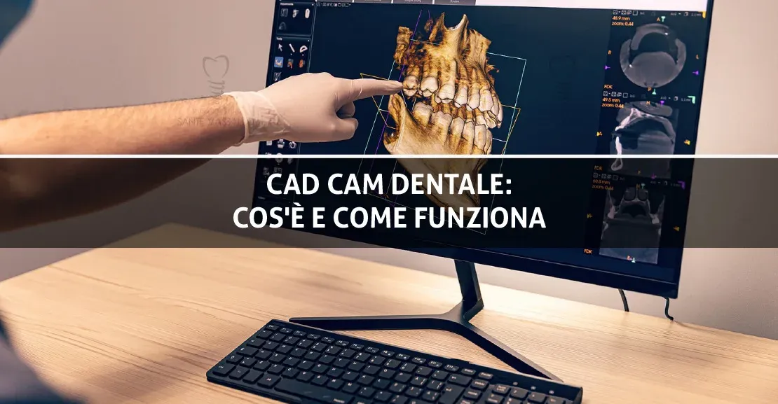 CAD CAM dentale: cos'è e come funziona