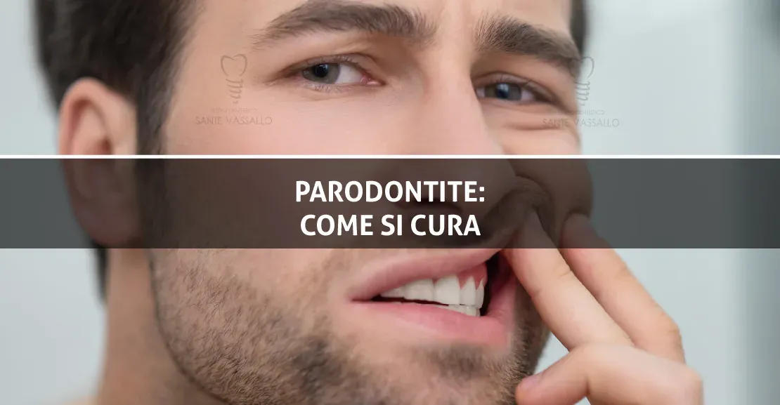 Parodontite: come si cura