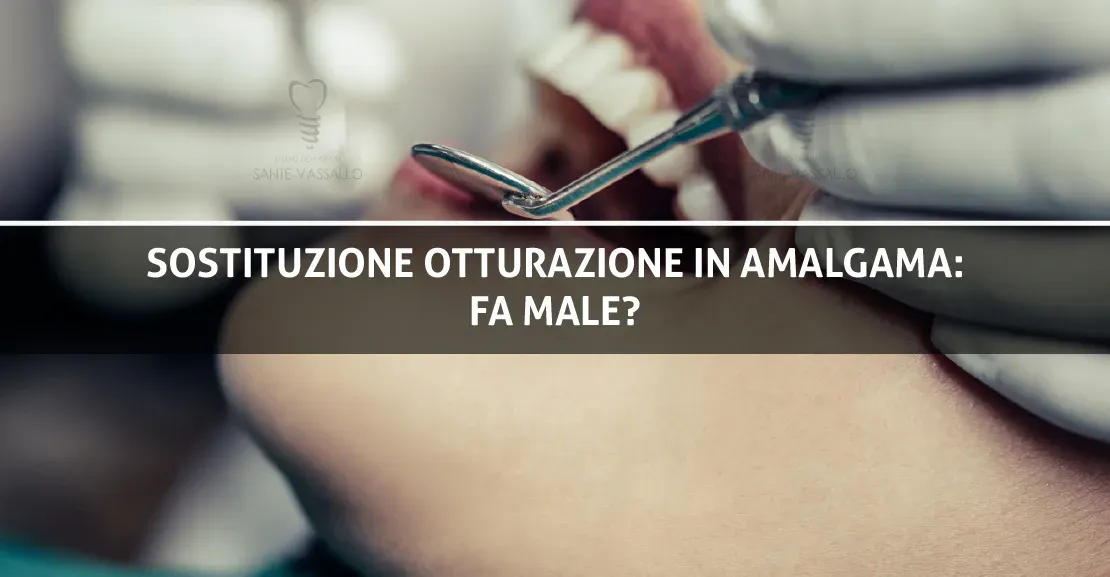 Sostituzione otturazione in amalgama: fa male? - Studio dentistico Sante vassallo