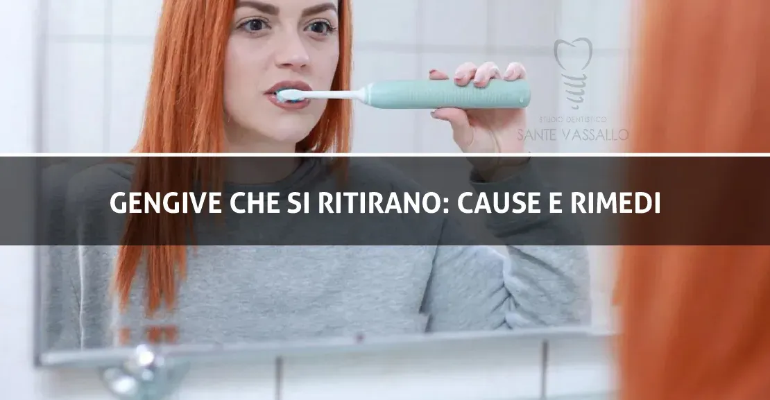 Gengive che si ritirano: cause e rimedi