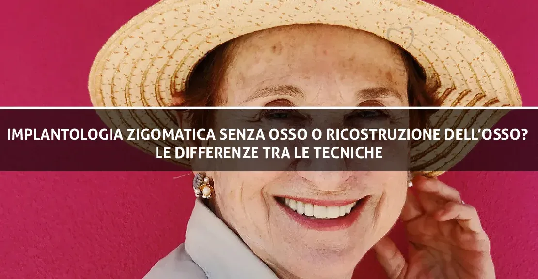 Implantologia zigomatica senza osso o ricostruzione dell’osso? Le differenze tra le tecniche