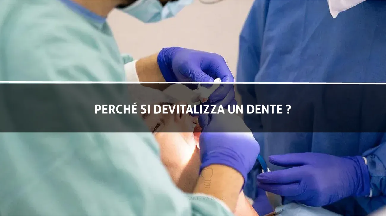 Perche si devitalizza un dente?