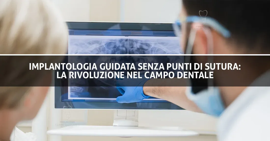 Implantologia guidata senza punti di sutura: la rivoluzione nel campo dentale