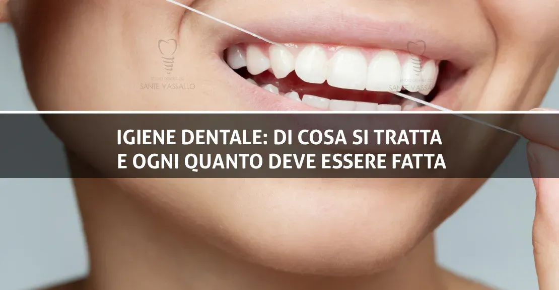 Igiene dentale: di cosa si tratta e ogni quanto deve essere fatta