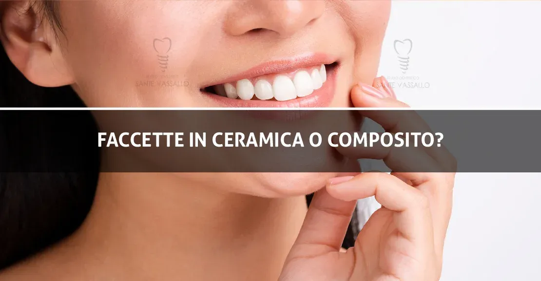 Faccette in ceramica o composito?