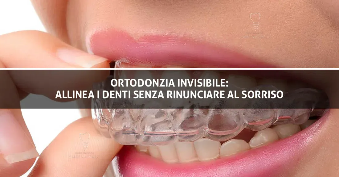 Copertina Articolo Sante Vassallo Ortodonzia Invisibile