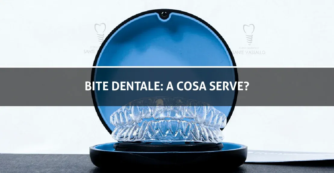 Bite dentale: a cosa serve?