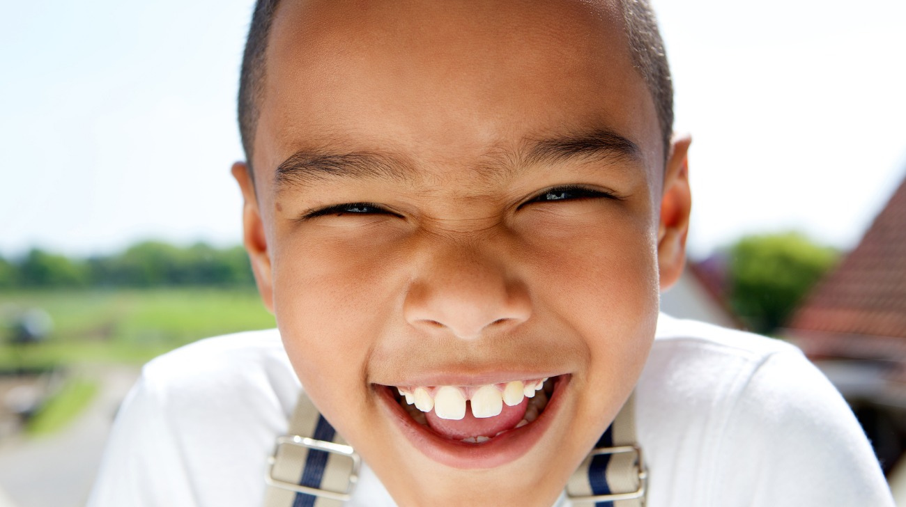 diastema dentale nei bambini