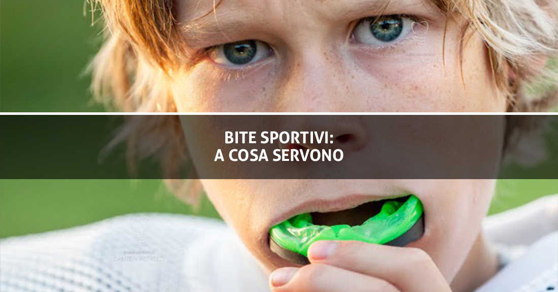 Bite-Sportivi-A-Cosa-servono---Studio-Dentistico-Sante-Vassallo---Copertina-Articolo-di-Blog