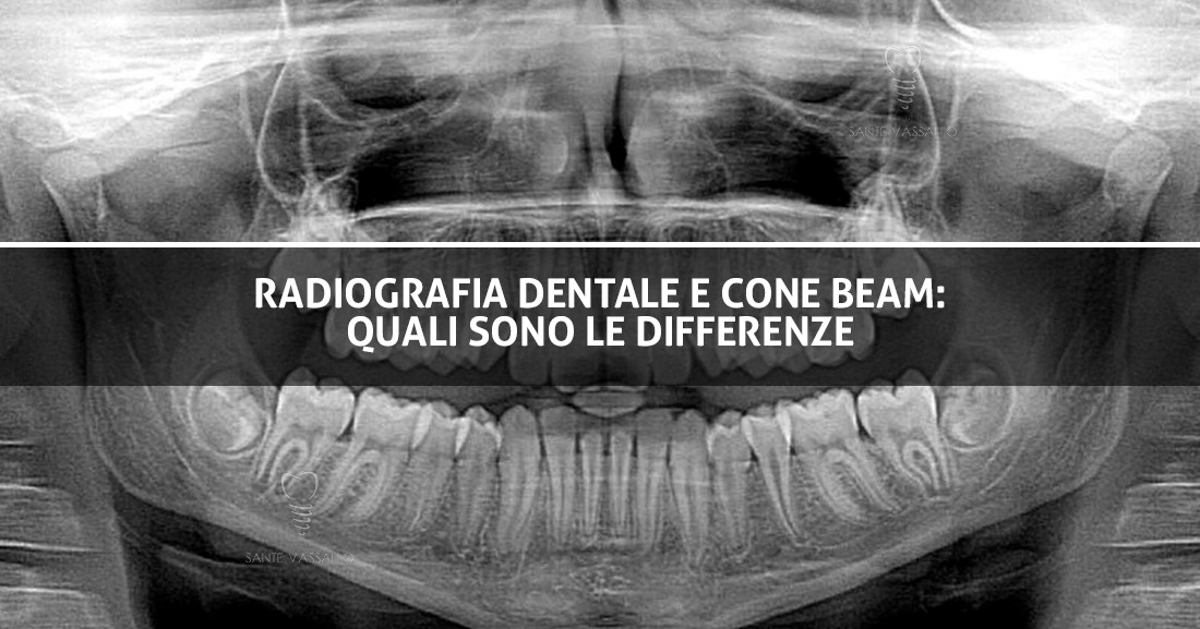 Radiografia dentale e cone beam: quali sono le differenze