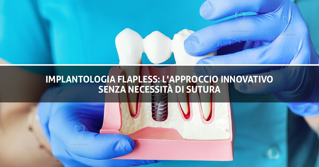 Implantologia flapless l'approccio innovativo senza necessità di sutura