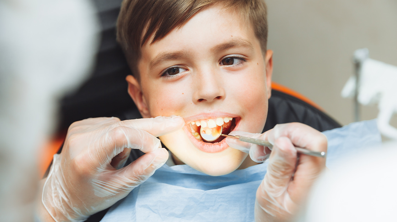 Sigillatura dei denti per bambini come proteggere i denti dei più piccoli - Studio Dentistico Sante Vassallo