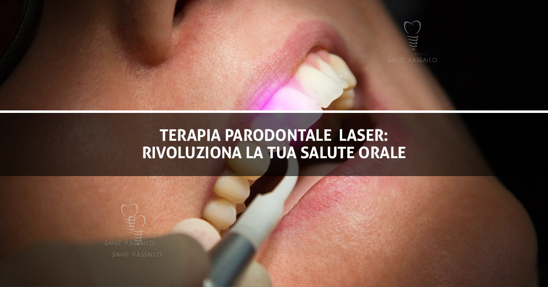 Terapia parodontale laser - Immagine Copertina - Studio Dentistico Sante Vassallo