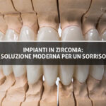Impianti-in-Zirconia-Scopri-la-Soluzione-Moderna-per-un-Sorriso-Perfetto---Copertina---Studio-Dentistico-Sante-Vassallo