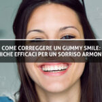 Copertina-Blog-Gummy Smile - Studio dentistico Sante Vassallo