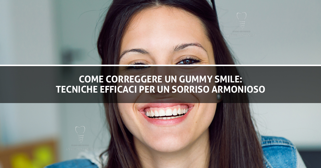 Copertina-Blog-Gummy Smile - Studio dentistico Sante Vassallo