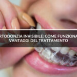 donna-con-mascherina-invisibile- Studio Dentistico Sante Vassallo- ortodonzia-invisibile