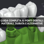 Copertina Blog - Ponti Dentali - Studio Dentistico Sante Vassallo