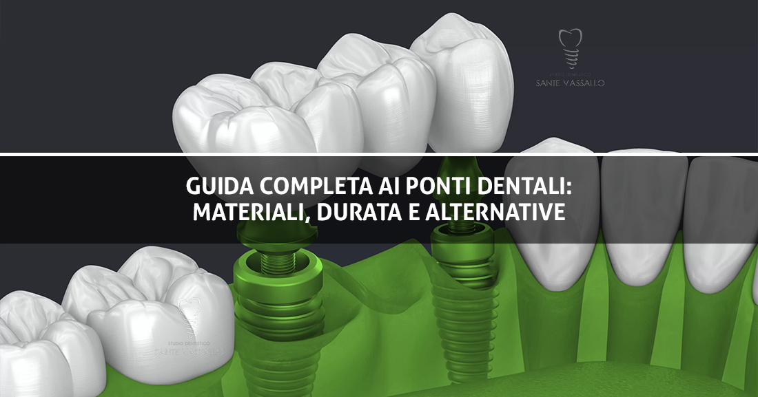 Copertina Blog - Ponti Dentali - Studio Dentistico Sante Vassallo