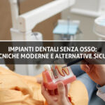 Impianti dentali senza osso - Studio Dentistico Sante Vassallo - Copertina Blog