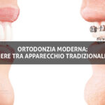 Ortodonzia moderna: come scegliere tra apparecchio tradizionale e invisibile