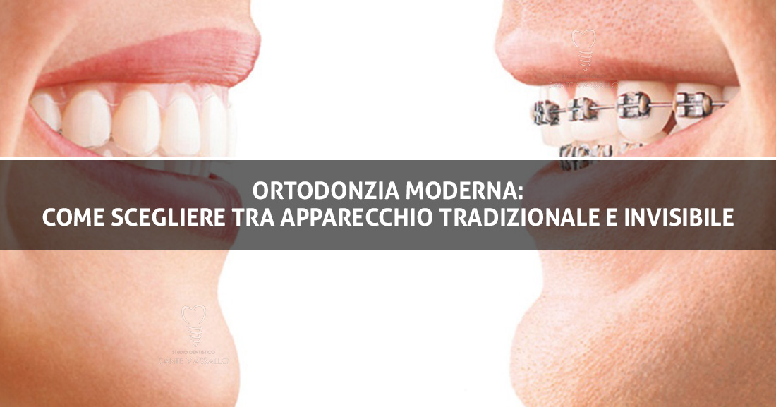 Ortodonzia moderna: come scegliere tra apparecchio tradizionale e invisibile