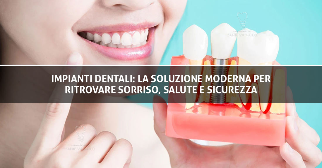 Copertina Sito - Impianti Dentali - Studio Dentistico Sante Vassallo