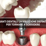 Copertina Sante - Impianti Dentali