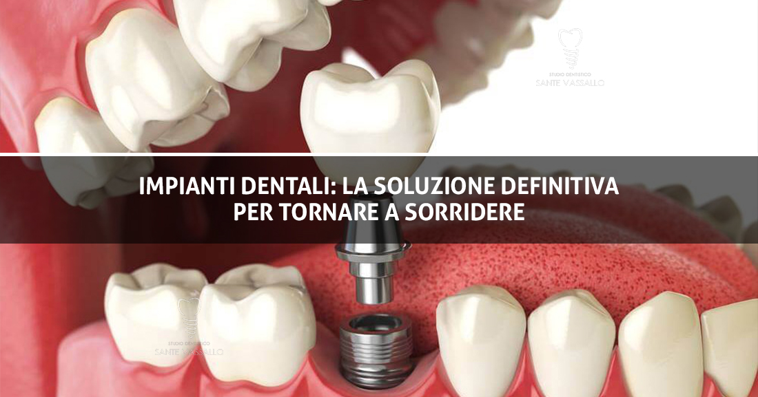 Copertina Sante - Impianti Dentali