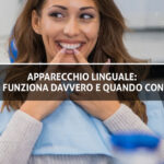Apparecchio linguale - come funziona davvero e quando conviene