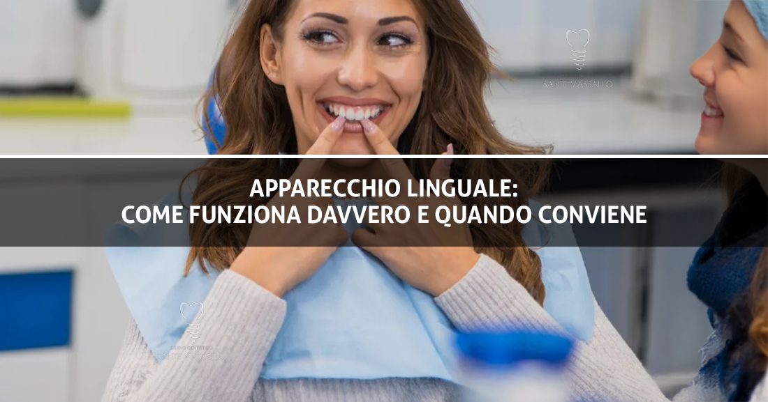 Apparecchio linguale - come funziona davvero e quando conviene