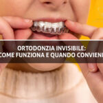 Ortodonzia Invisibile - Studio Dentistico Sante Vassallo