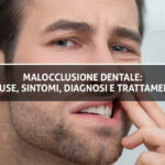 Malocclusione Dentale - Studio Dentistico Sante Vassallo