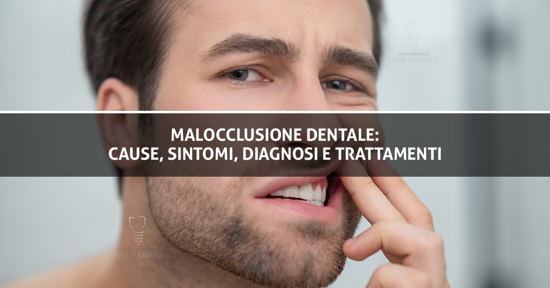 Malocclusione Dentale - Studio Dentistico Sante Vassallo