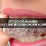 Copertina Articolo Sante Vassallo Ortodonzia Invisibile