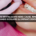 Copertina Sante Vassallo - Dente Devitalizzato Nero